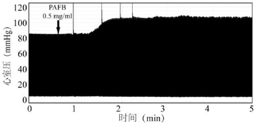 Metabolite extract of intestinal flora in American cockroach excrement as well as preparation method and application of extract