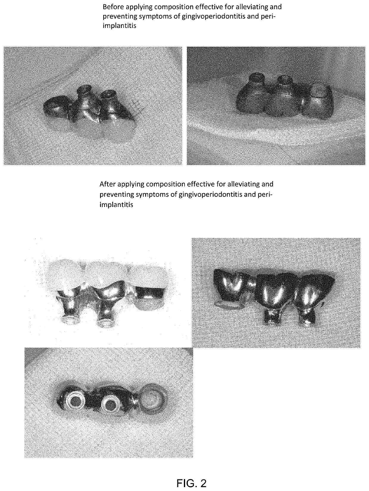 Composition for treating and preventing gingivoperiodontitis or peri-implantitis, and interdental brush coated with same