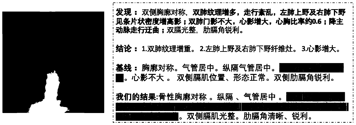 Medical report generating model based on relation model, and generating method thereof