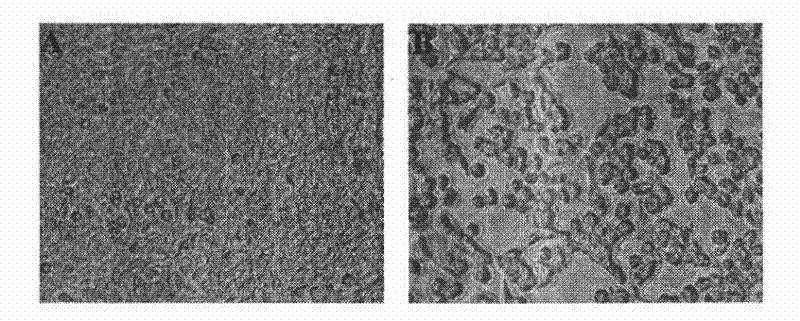 Recombinant adenovirus expressing Asian type 1 foot-and-mouth disease virus vlp and its application