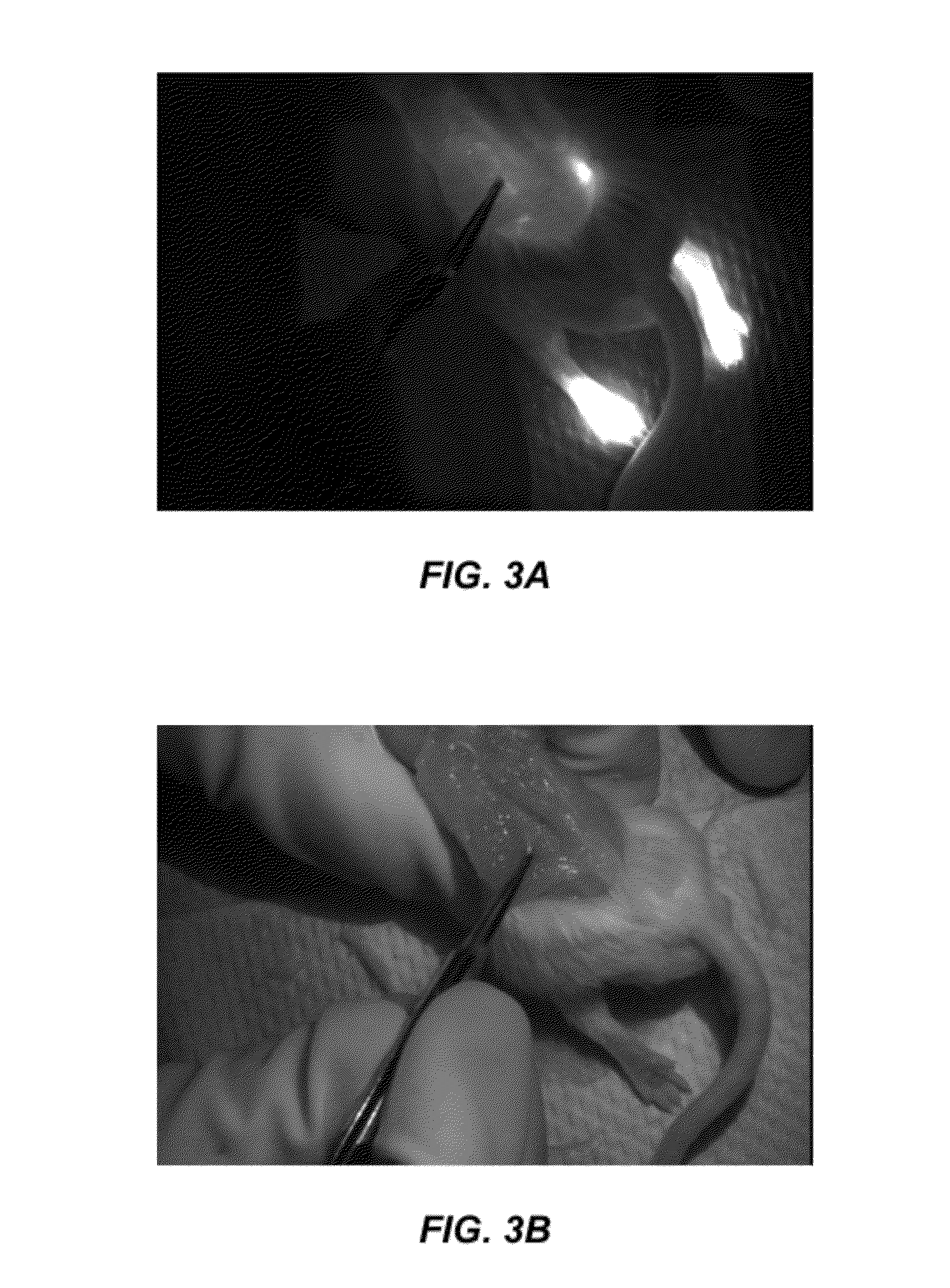 Imaging methods and compositions comprising fluorescent dyes associated with viral components for nerve imaging