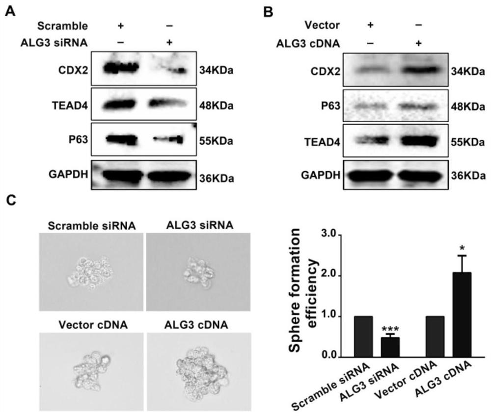 Biomarker for diagnosing abortion and application thereof