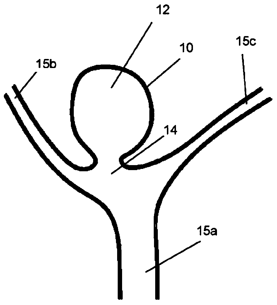 Aneurysm closure device