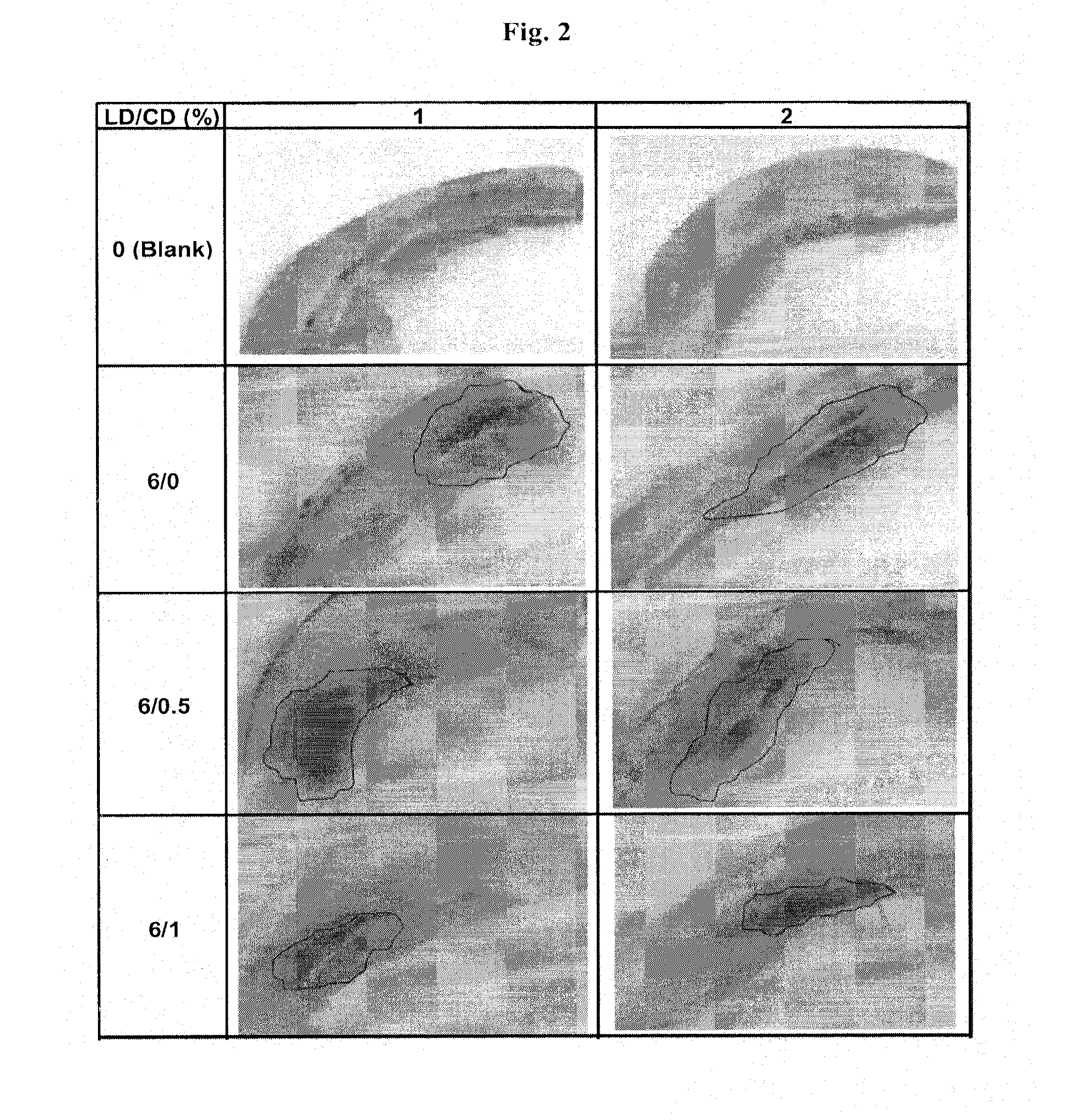 Continuous administration of l-dopa, dopa decarboxylase inhibitors, catechol-o-methyl transferase inhibitors and compositions for same