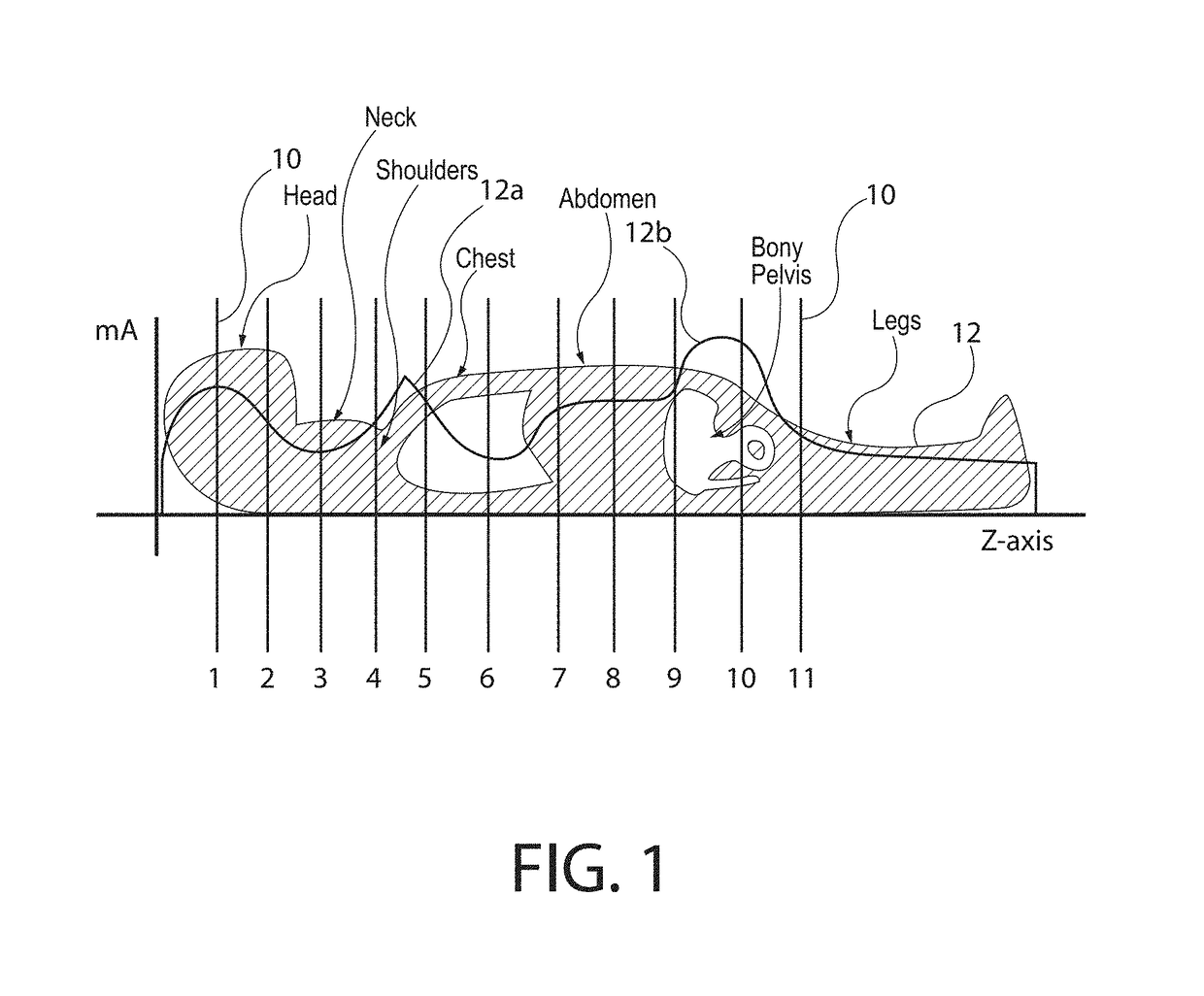 Image processing system and method for detecting an anatomical marker within an image study