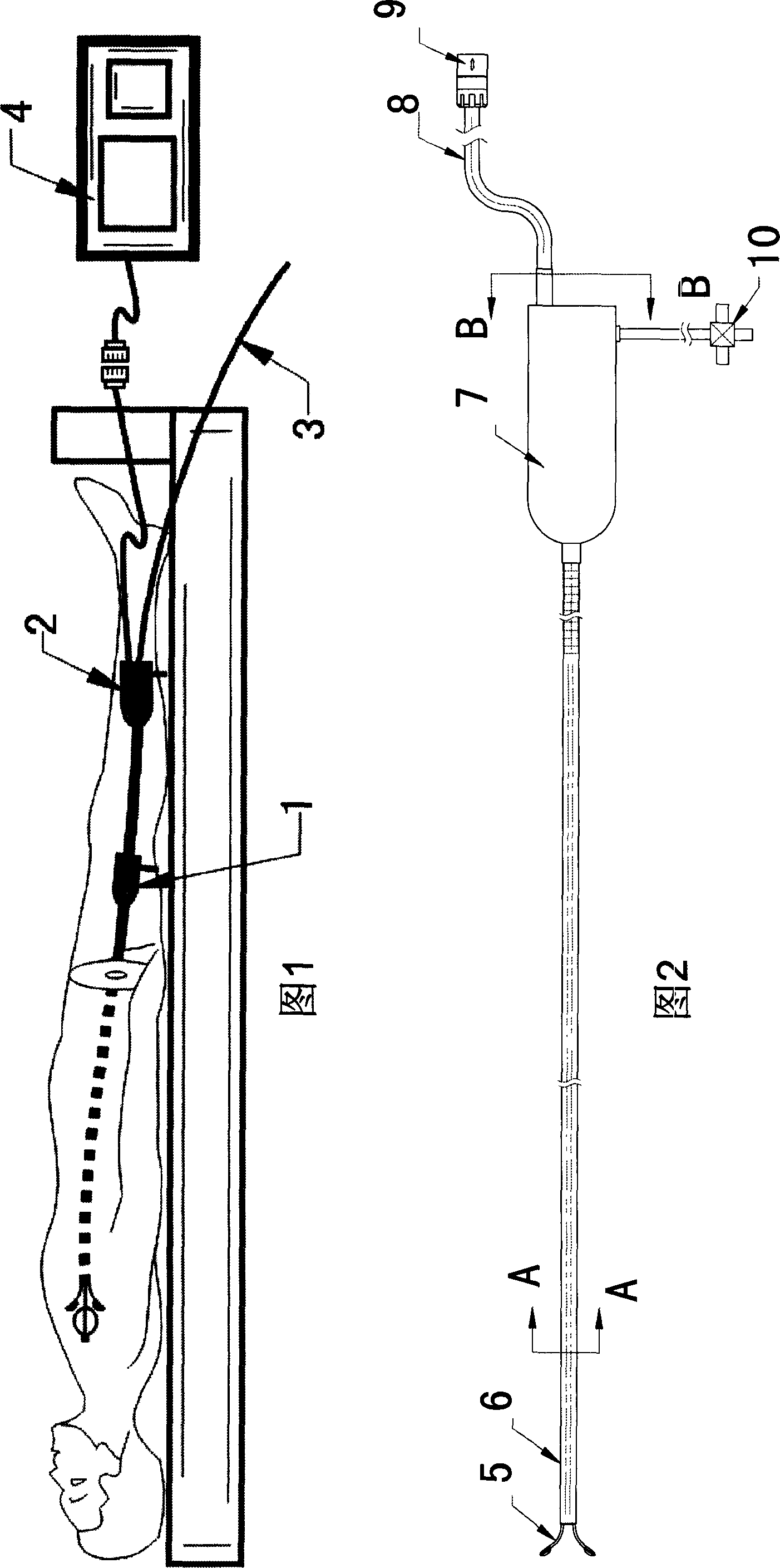 Cardiac intervention ablation catheter