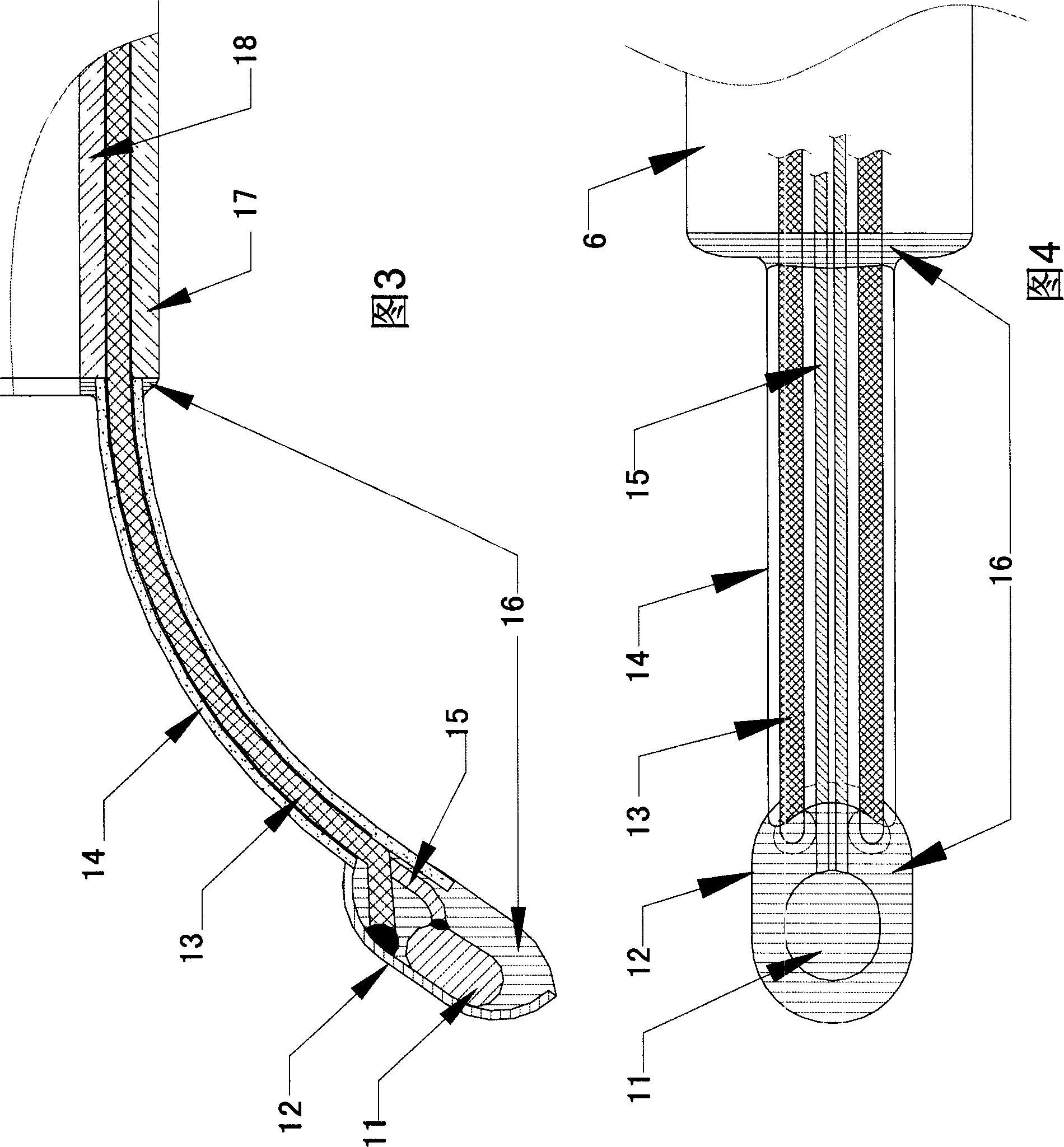 Cardiac intervention ablation catheter