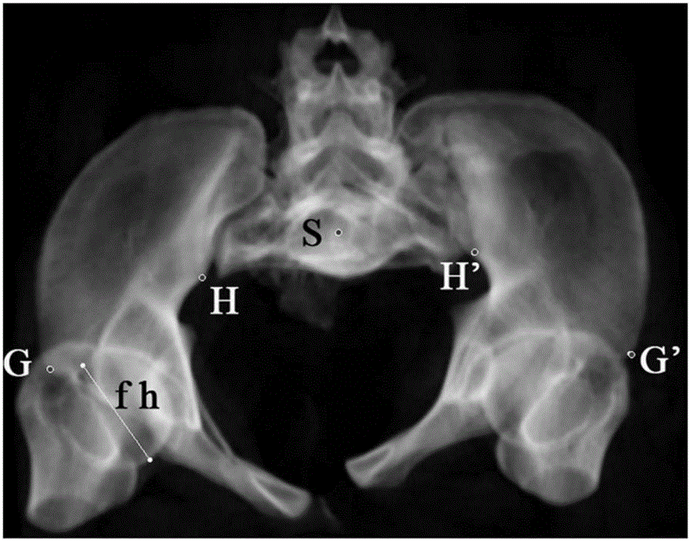 Pelvis displacement measuring method based on pelvis plain film