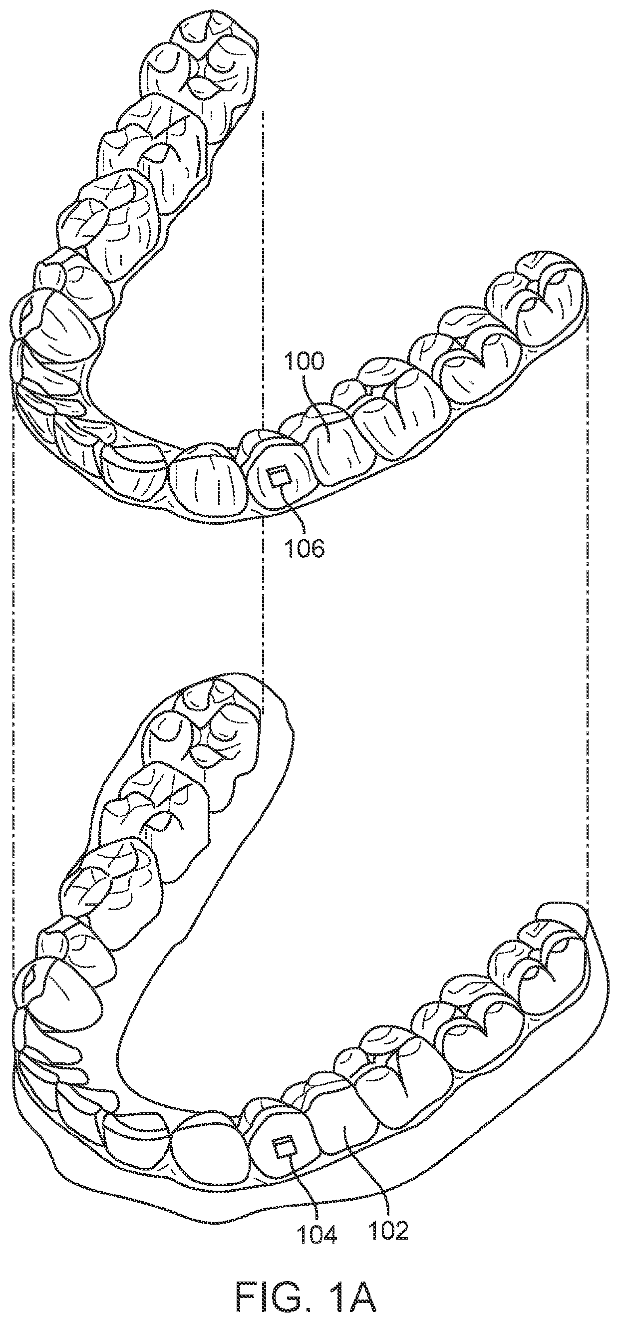 Direct fabrication of aligners with interproximal force coupling