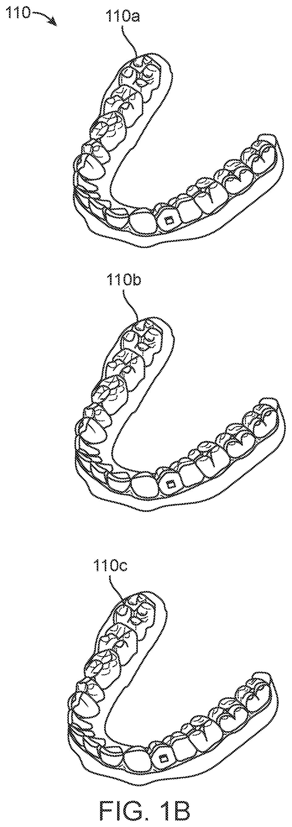 Direct fabrication of aligners with interproximal force coupling