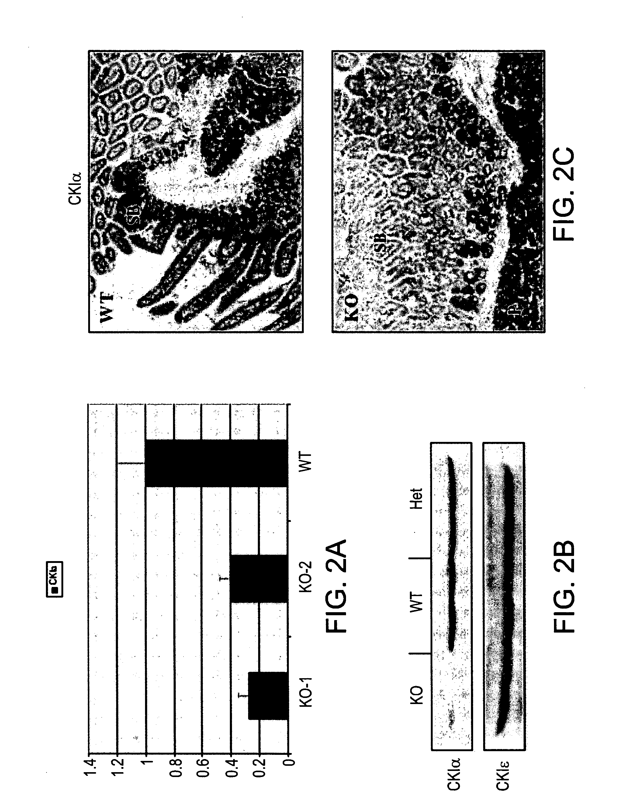 Methods of killing cells and use of same in prevention and treatment of cancer