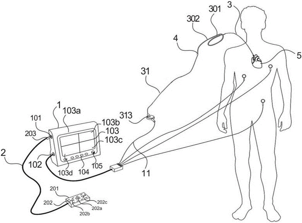 Electrocardiogram monitoring system