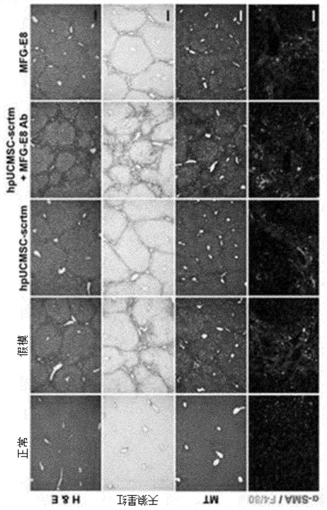 Composition for preventing or treating tissue fibrosis using mfg-e8