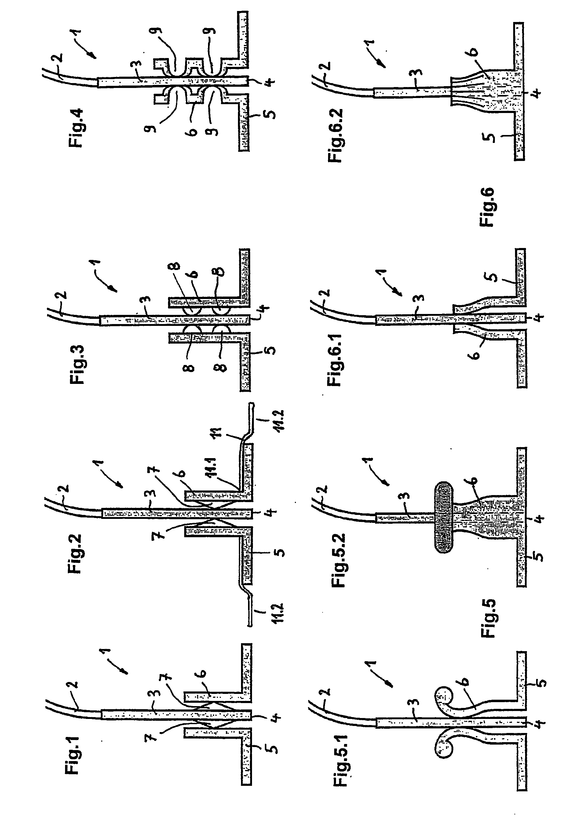 Laser needle for performing a combined laser needle/electric acupuncture