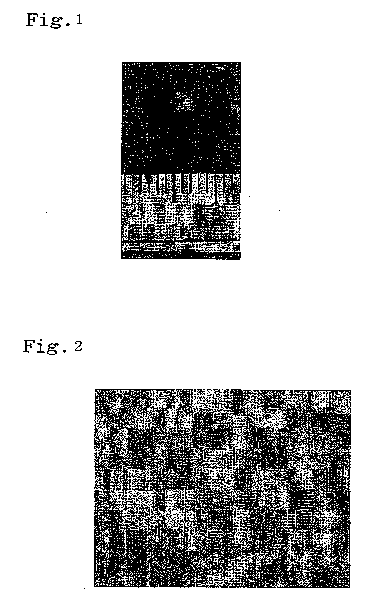 Method of bone regeneration