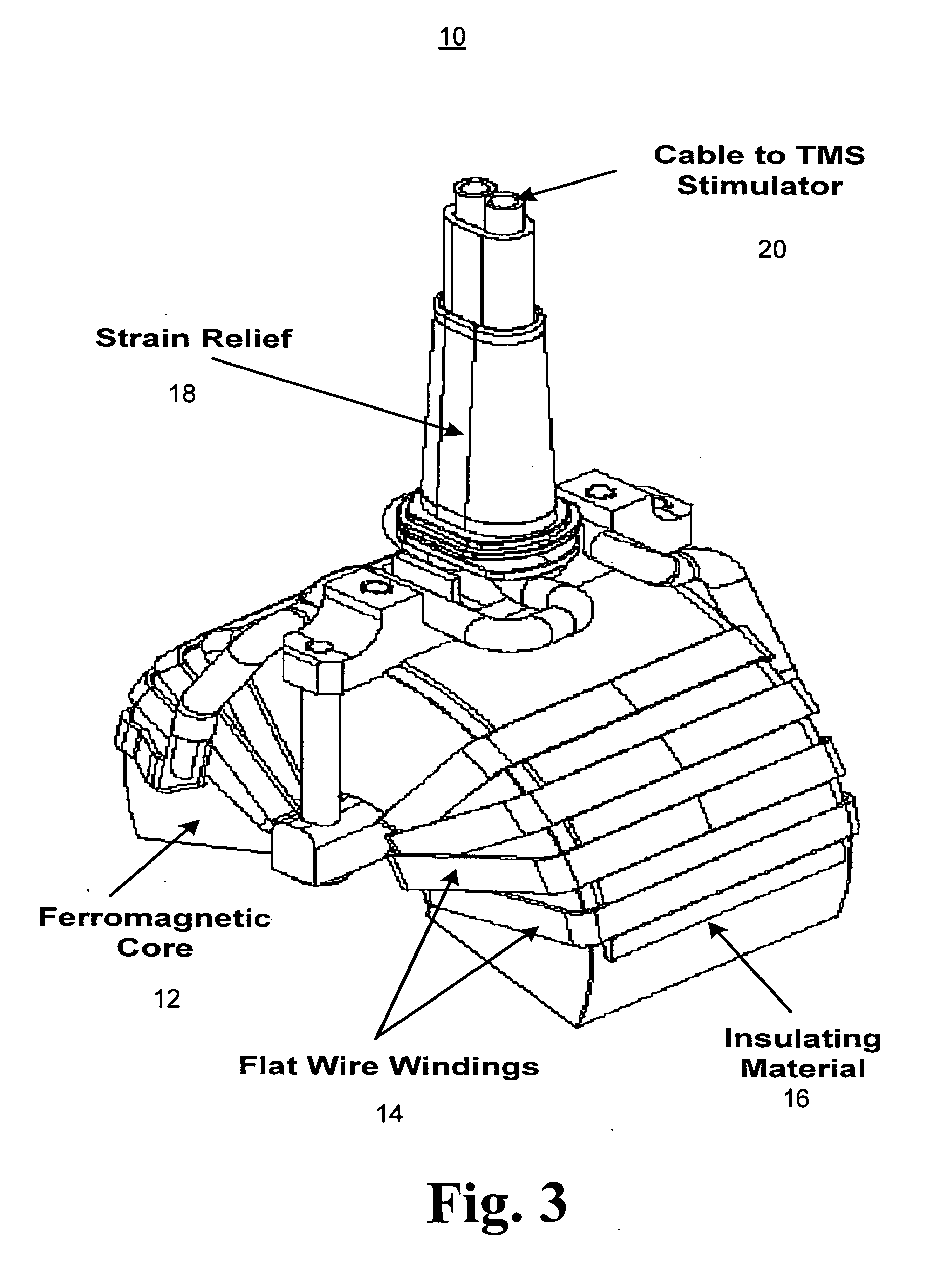 Seizure therapy method and apparatus