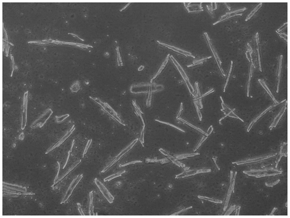 A method for isolation and culture of adult mouse atrial myocytes