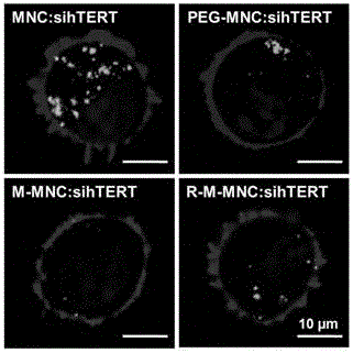 Bionic magnetosome loaded with siRNA and preparation method of magnetosome