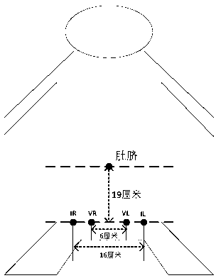 Bioelectrical impedance based urge incontinence recognition method