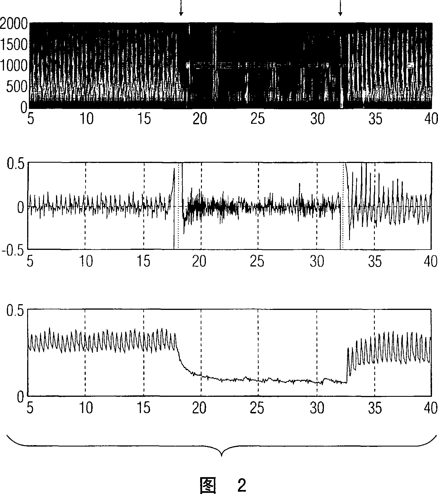 Method and apparatus for presenting information concerning flow behavior of a body fluid externally measured by ultrasound