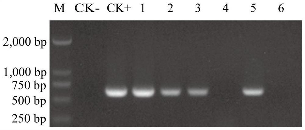 A kind of 2-methyl citrate high-yielding genetically engineered bacteria and its construction method