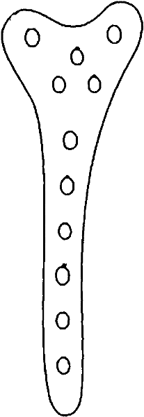 Proximal tibial platform rear dissection type support locking bone fracture plate