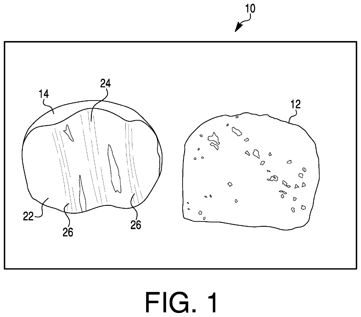 First metatarsophalangeal joint implant and method for placement