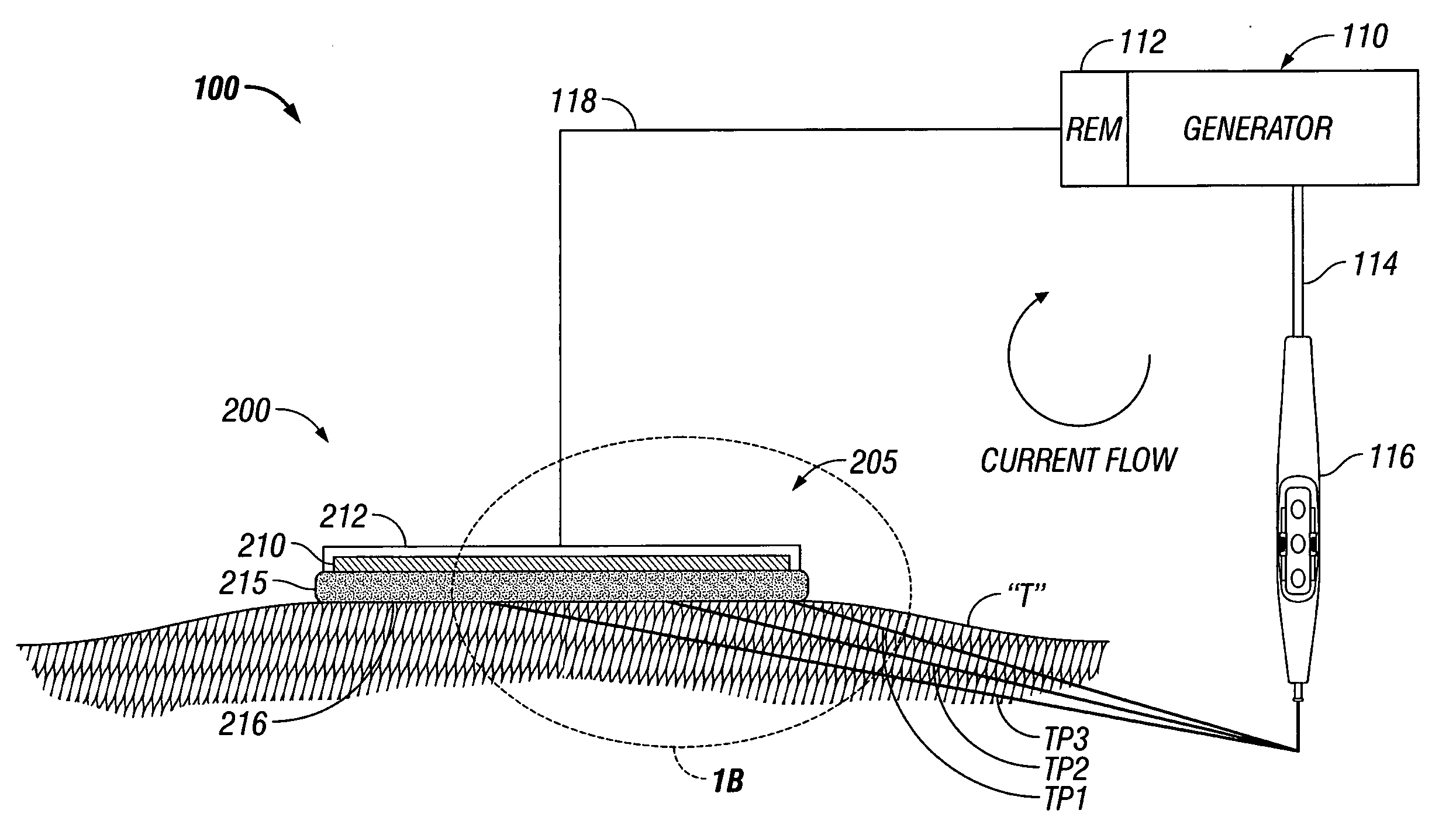 System and method for providing even heat distribution and cooling return pads