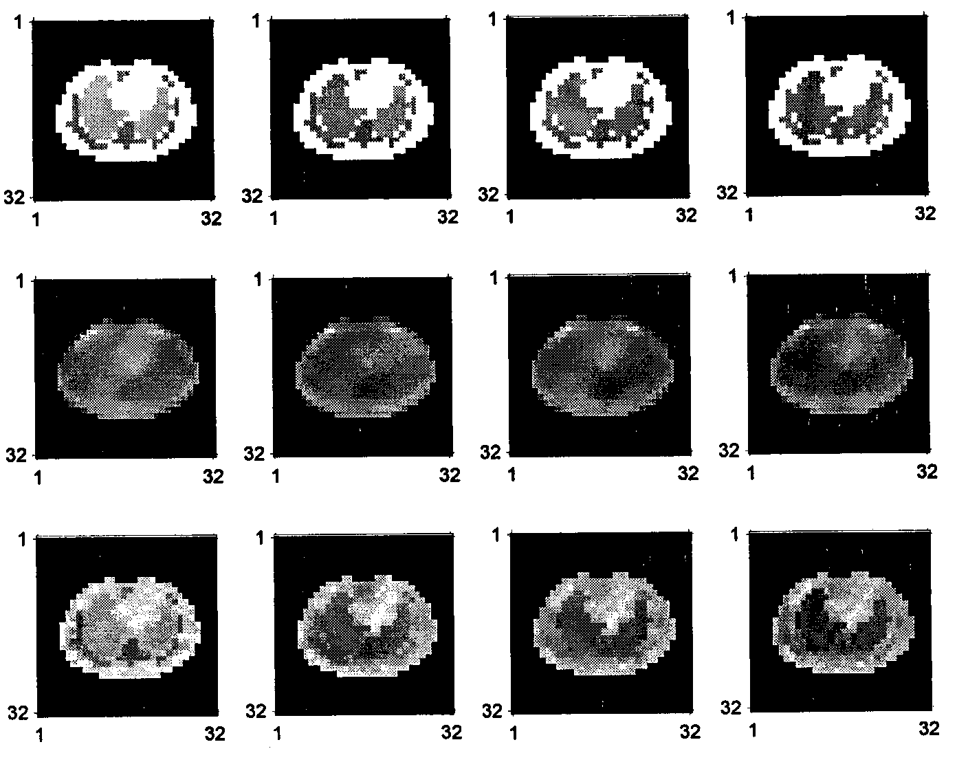 PET concentration reestablishing method based on Kalman filtration in limited sampling angle