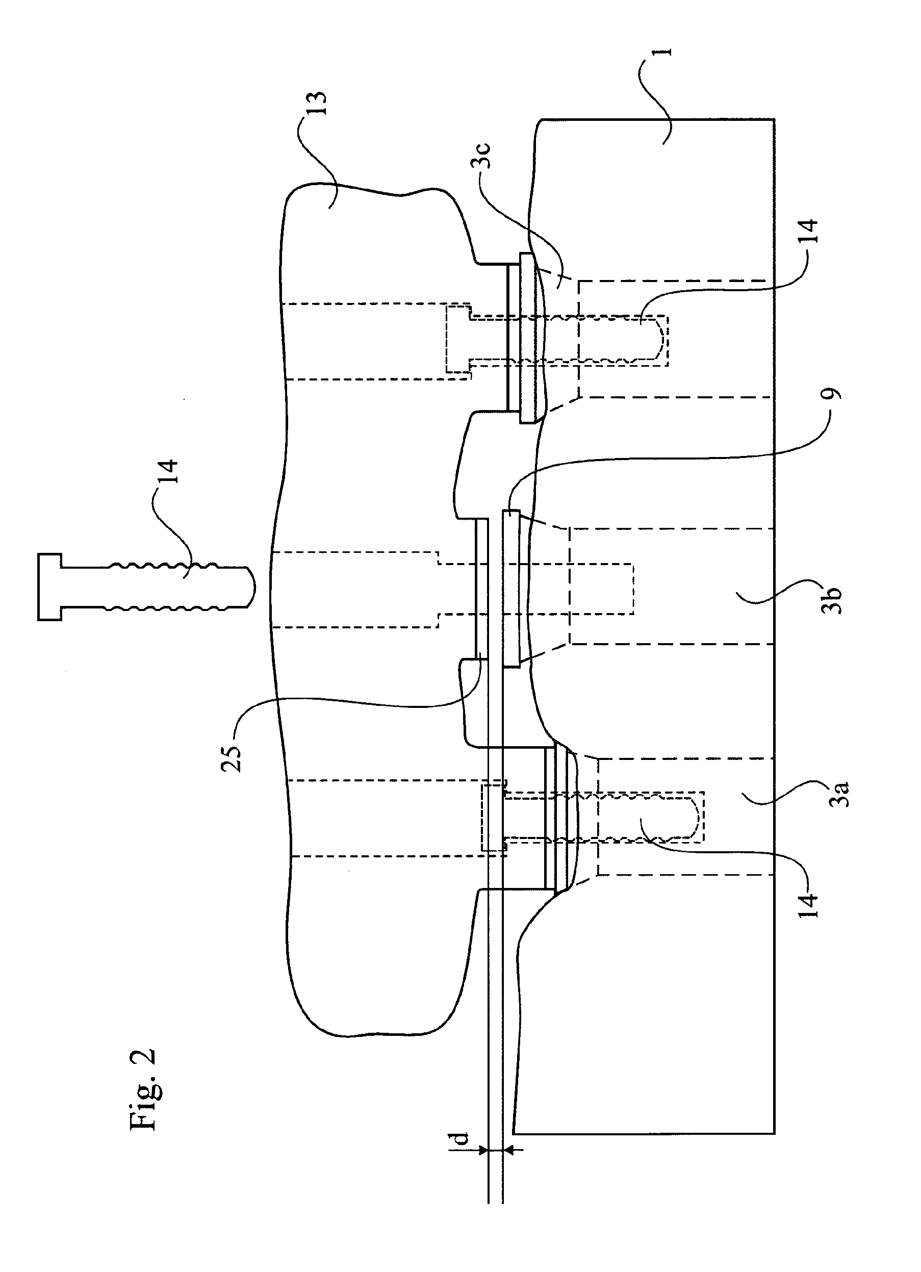 Dental implant, a dental implant kit and a method of securing a dental bridge to the jaw of the patient