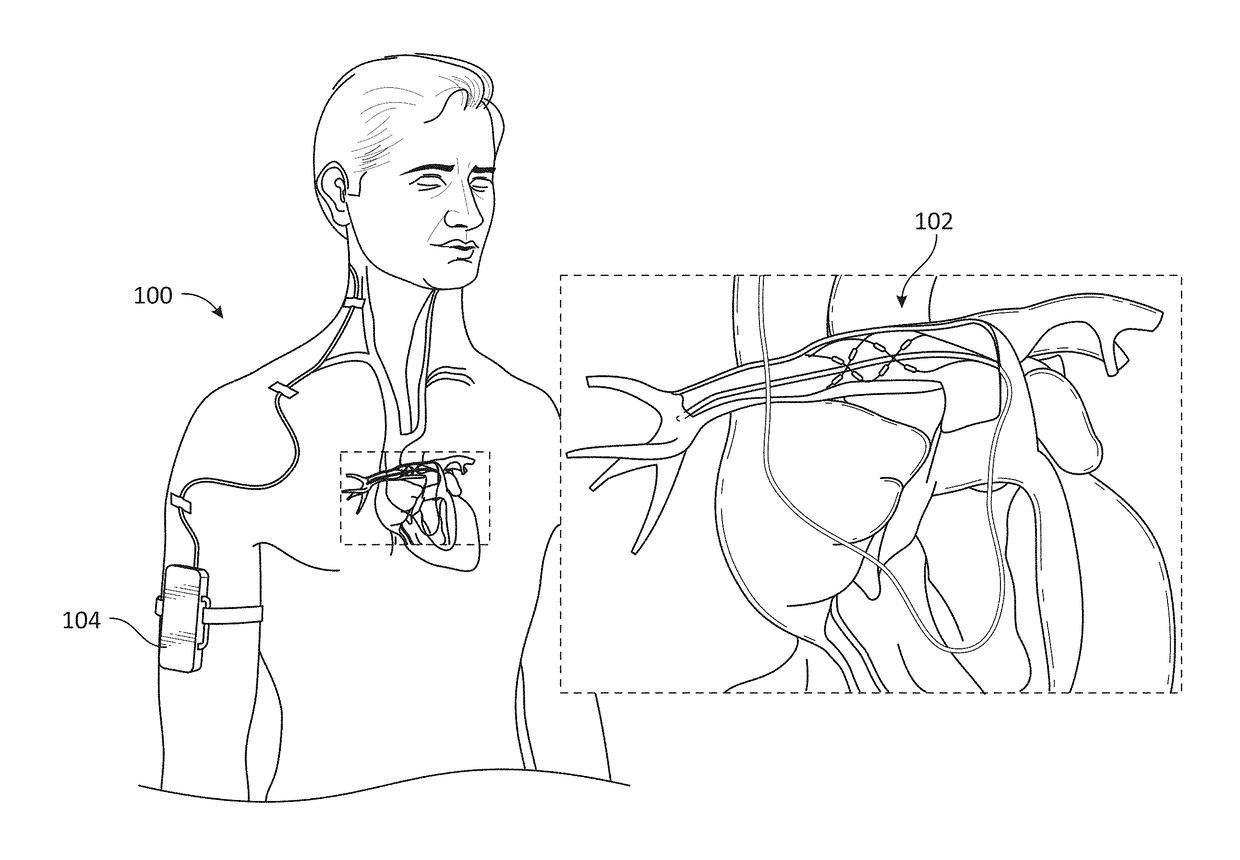 Methods of monitoring effects of neurostimulation