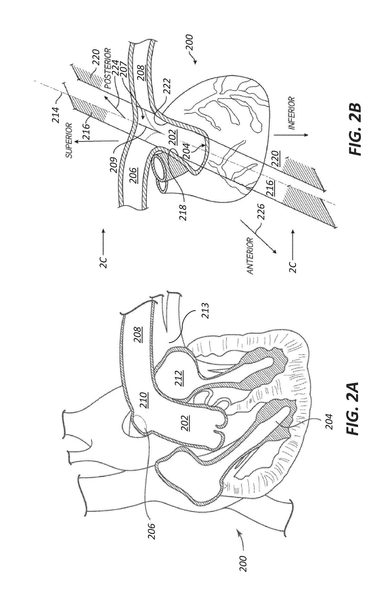 Methods of monitoring effects of neurostimulation