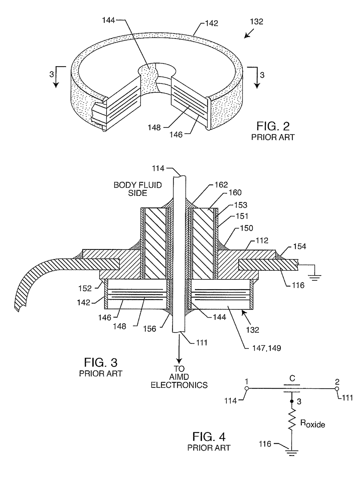 Low impedance oxide resistant grounded capacitor for an AIMD