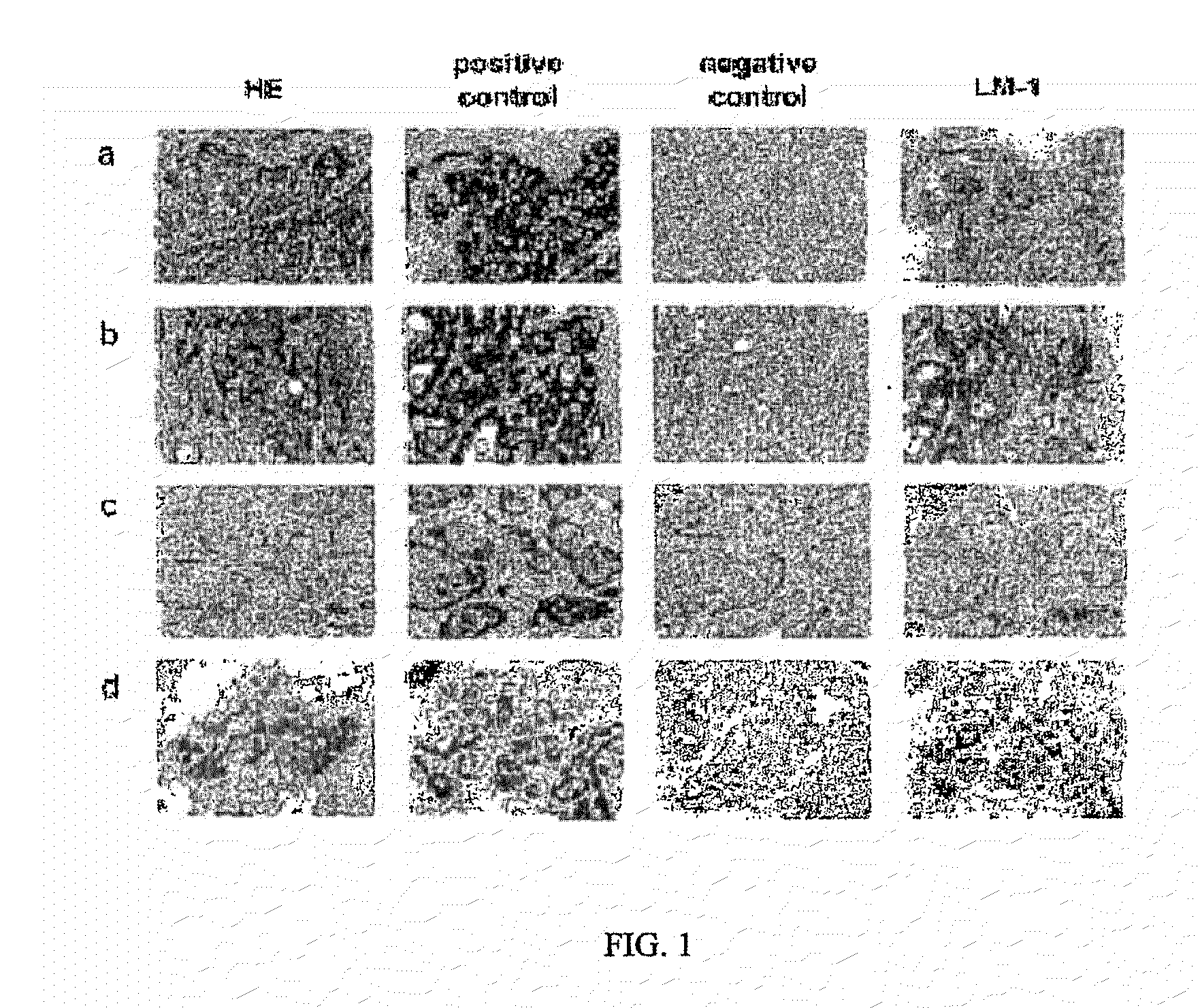 Neoplasm specific antibodies and uses thereof