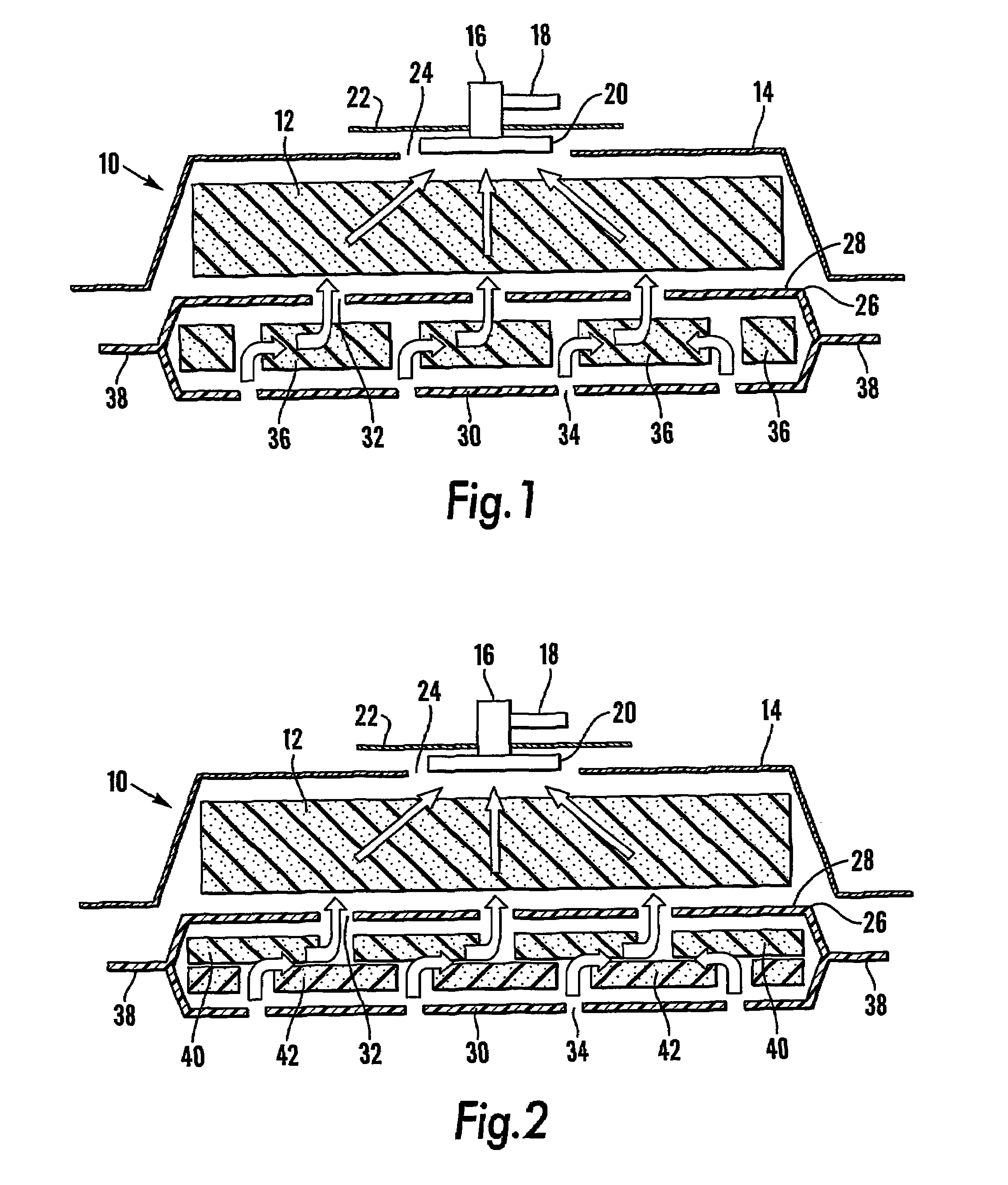 Removable wound closure