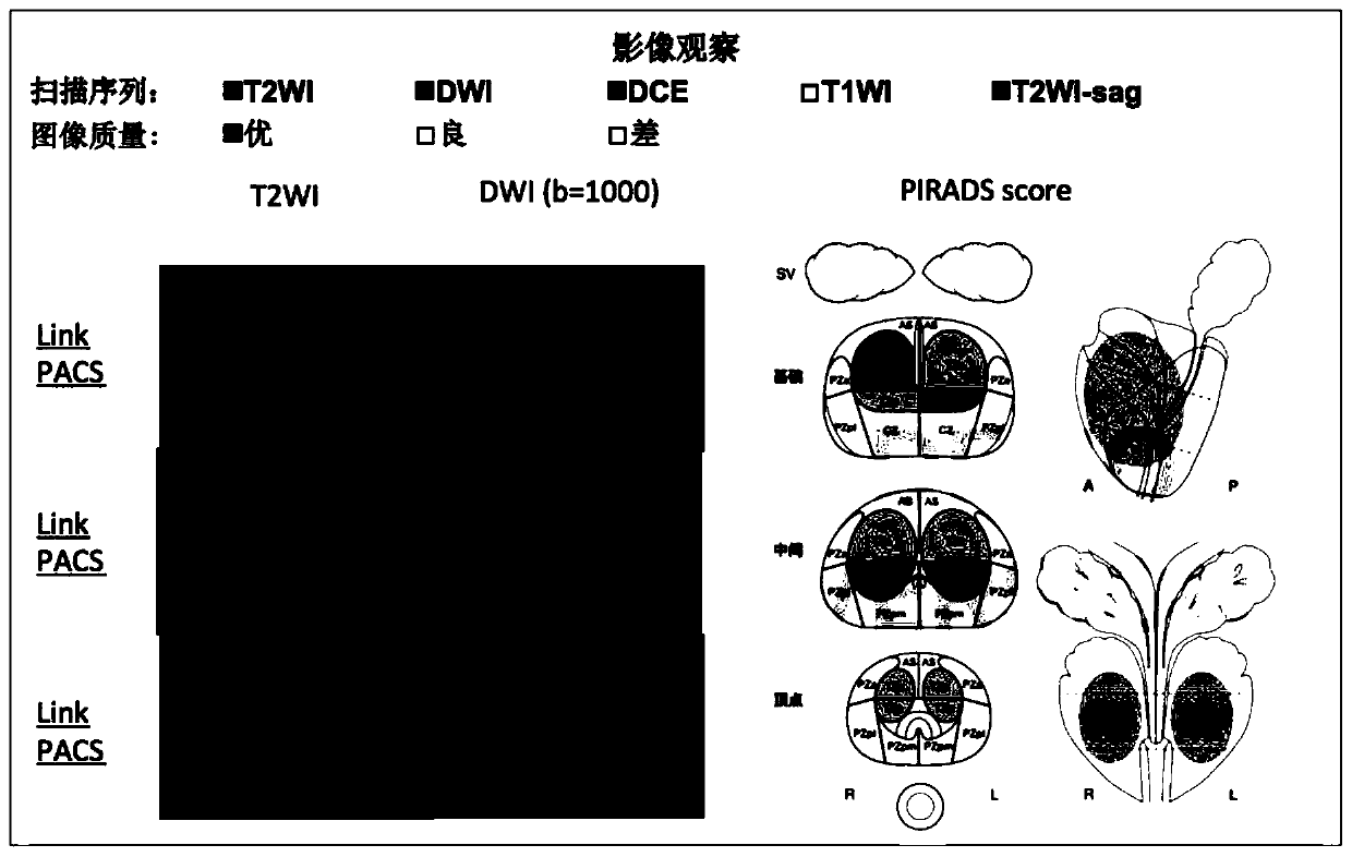 An intelligent image reading system for tumor imaging data