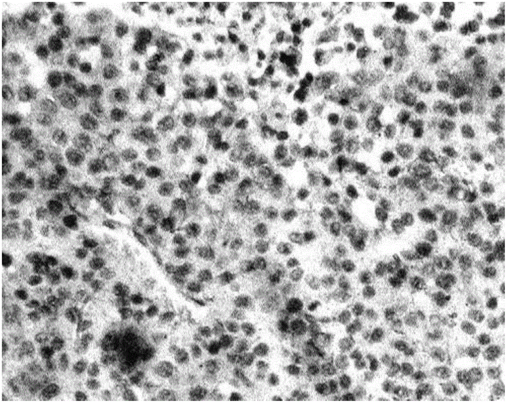 Grub polysaccharide component and preparation method and application thereof