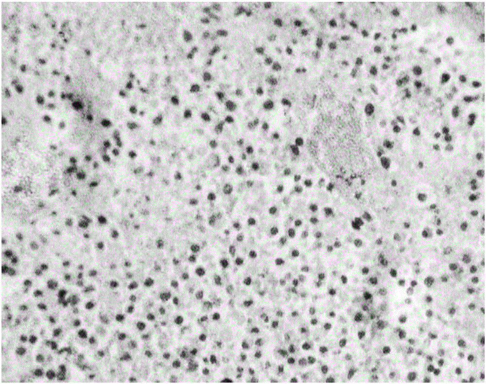 Grub polysaccharide component and preparation method and application thereof