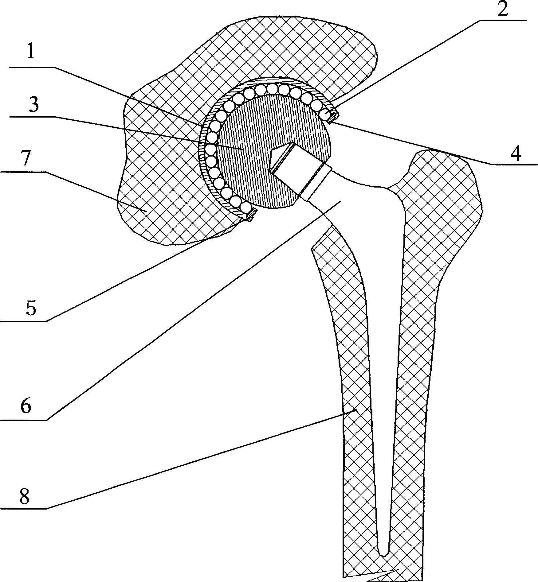 Rolling type bipolar head