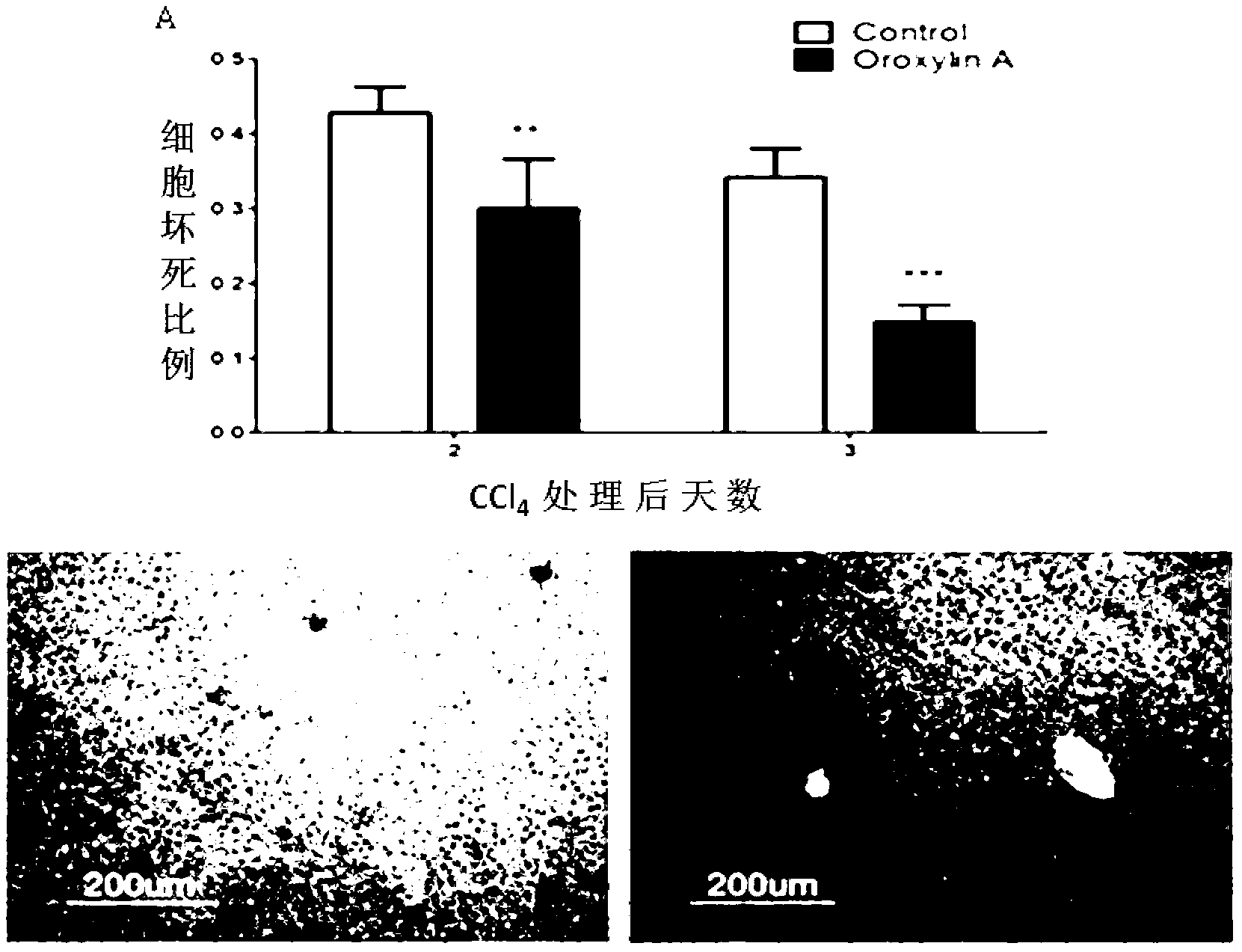 Application of Oroxylin A