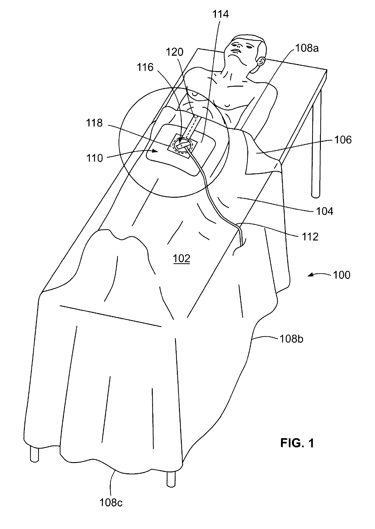 Zip strip draping system and methods of manufacturing same