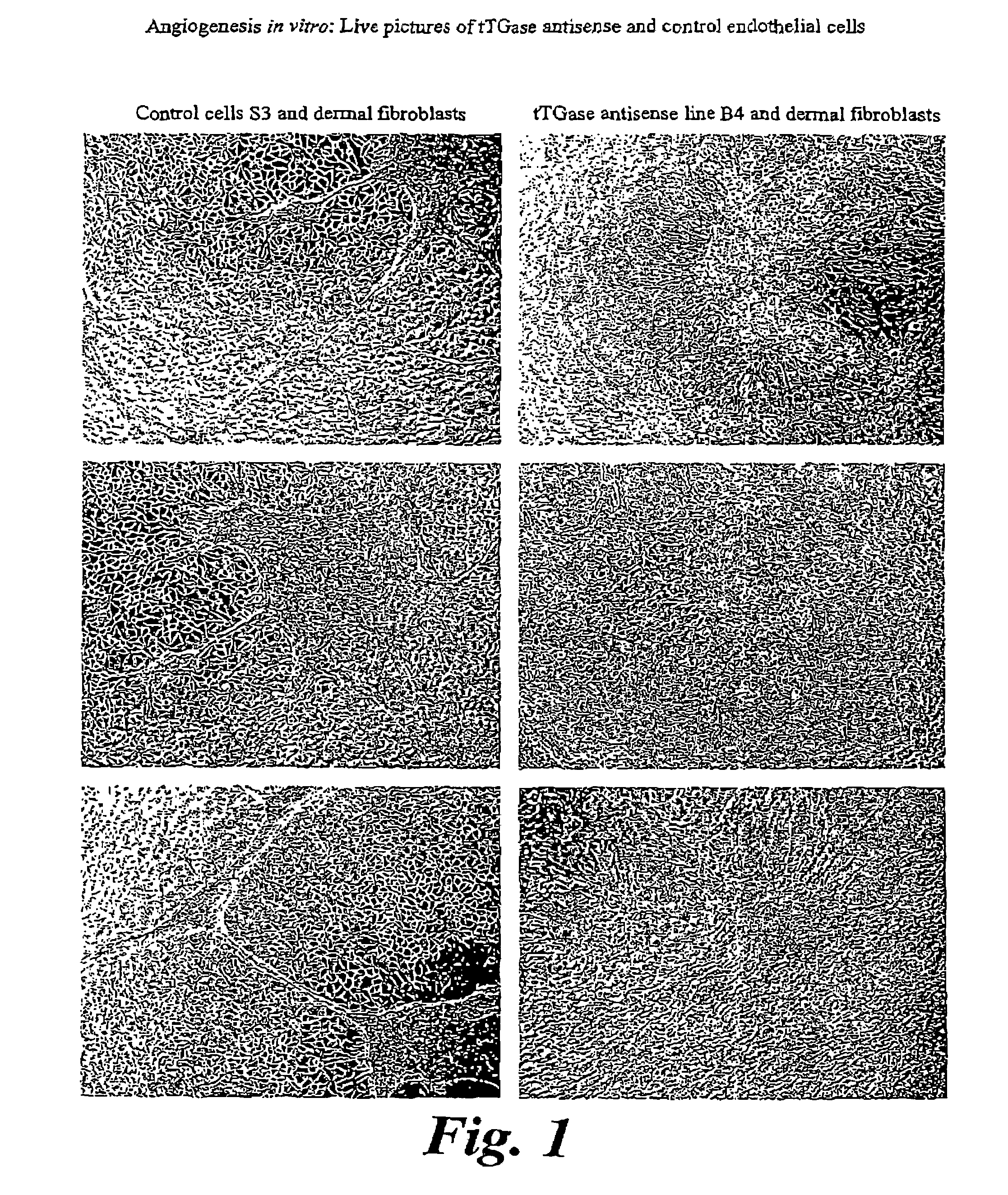 Transglutaminase for inhibiting angiogenesis