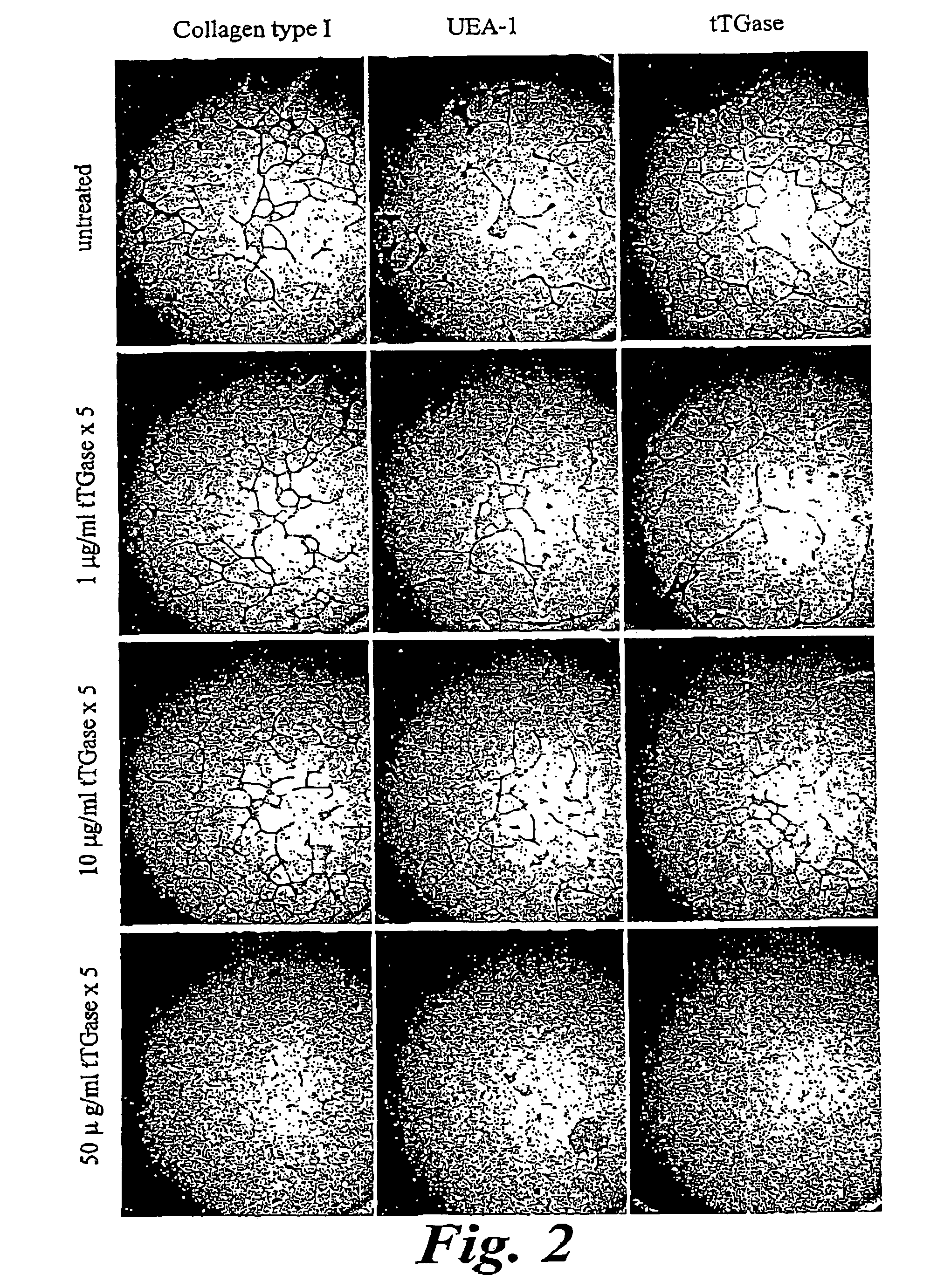 Transglutaminase for inhibiting angiogenesis