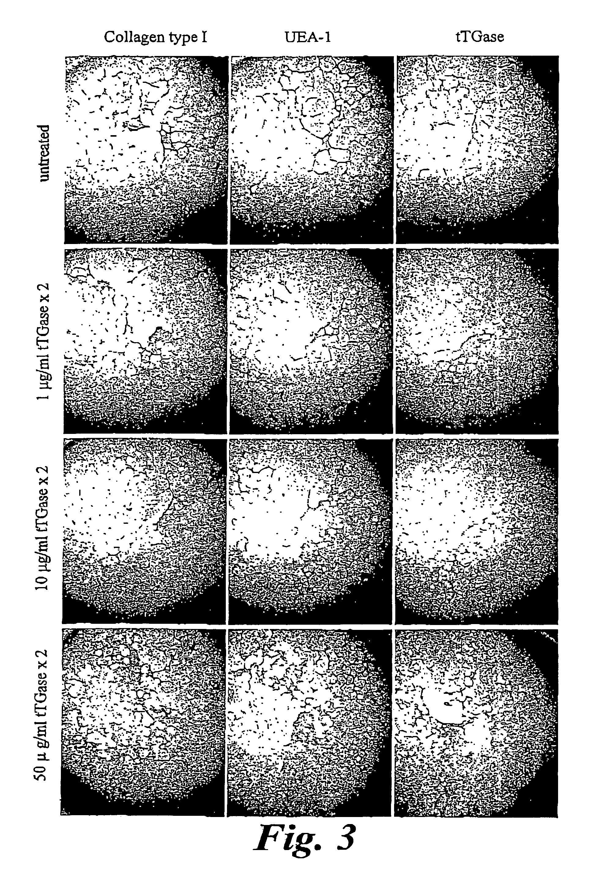 Transglutaminase for inhibiting angiogenesis