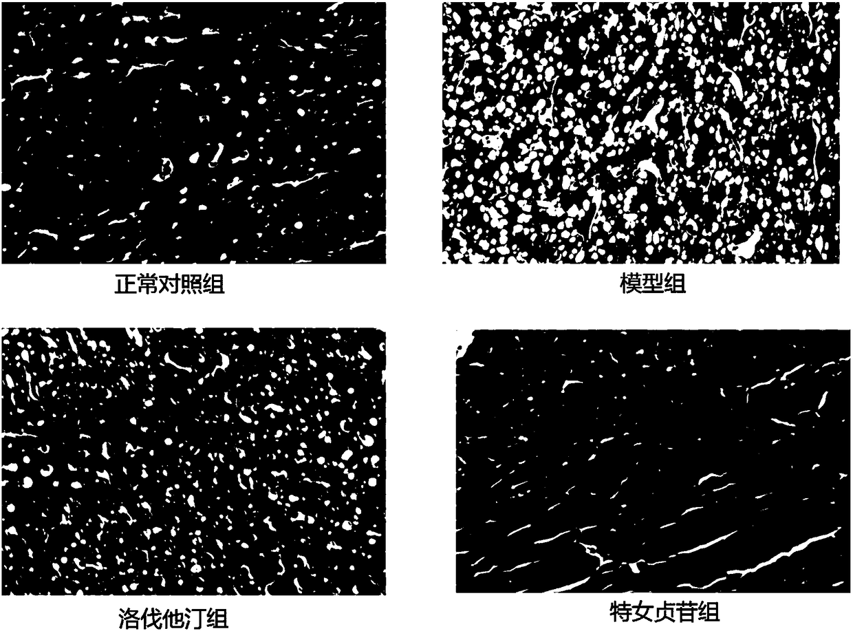 Application of teruzhenin and its composition and pharmaceutical preparation in lipid-lowering