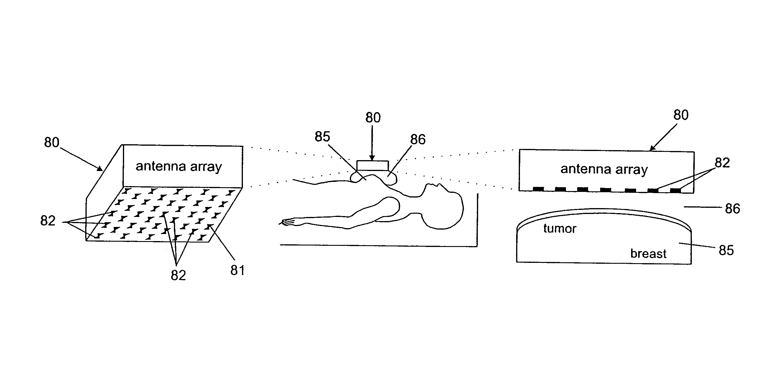 Microwave-based examination using hypothesis testing