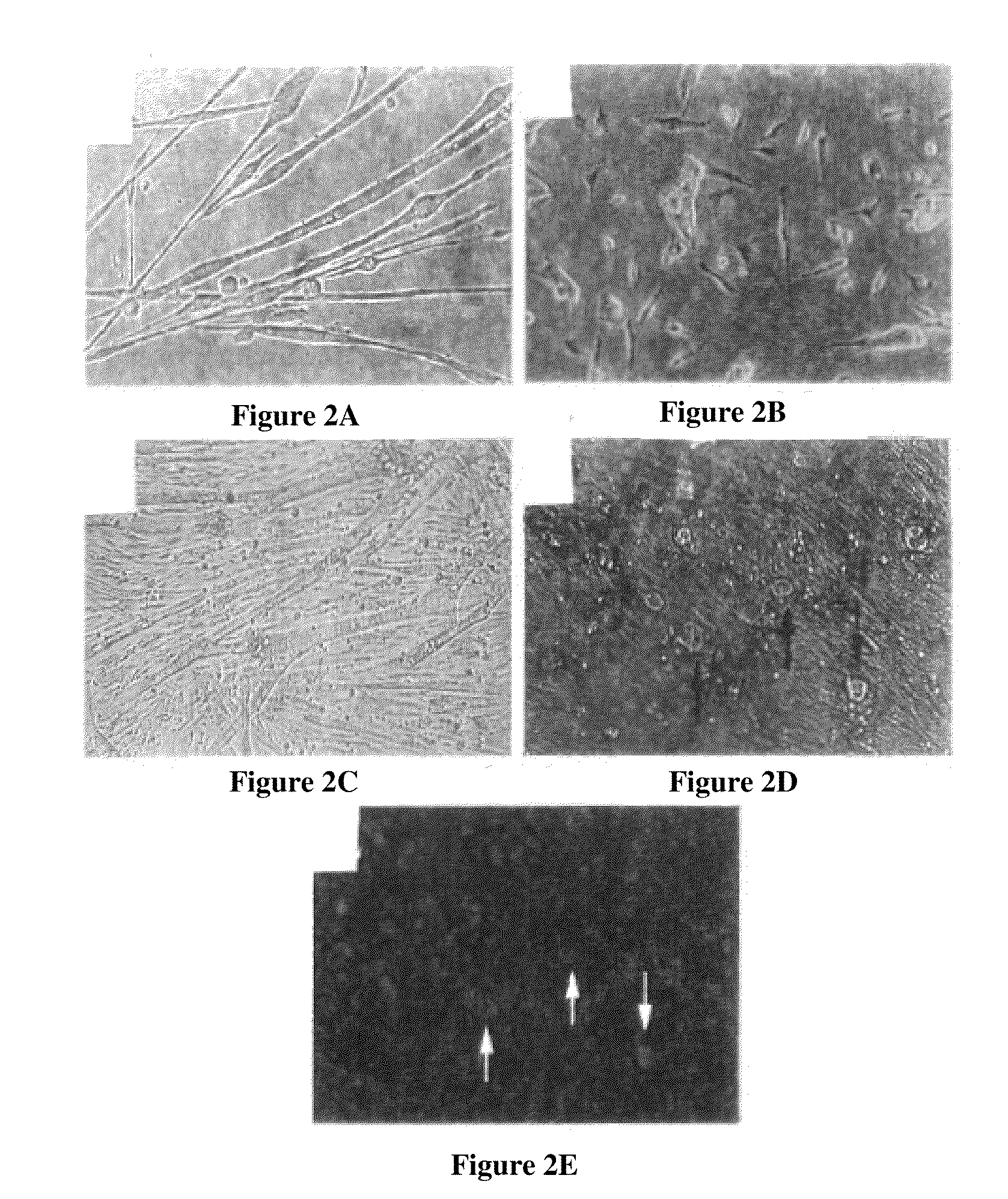 Bone augmentation utilizing muscle-derived progenitor compositions, and treatments thereof