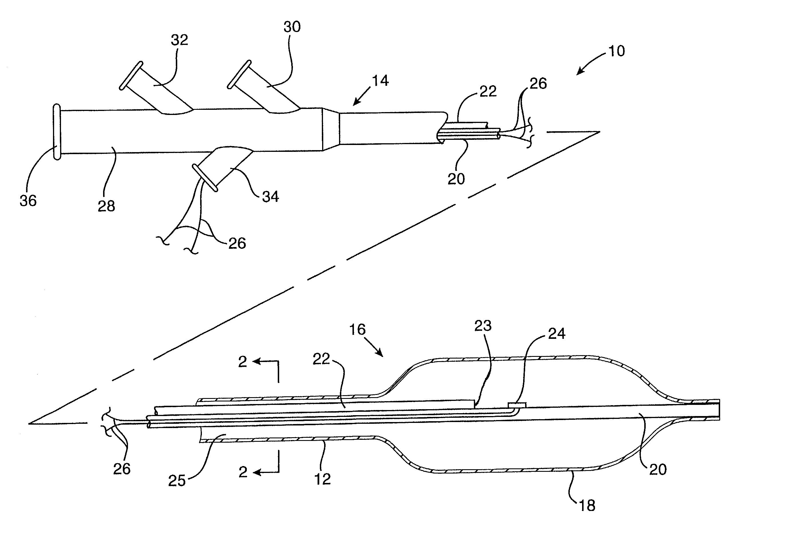 Apparatus and method for cryogenic inhibition of hyperplasia