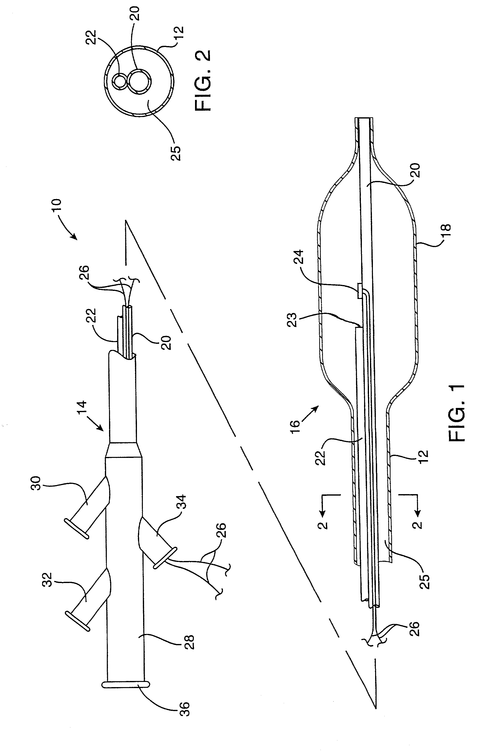 Apparatus and method for cryogenic inhibition of hyperplasia