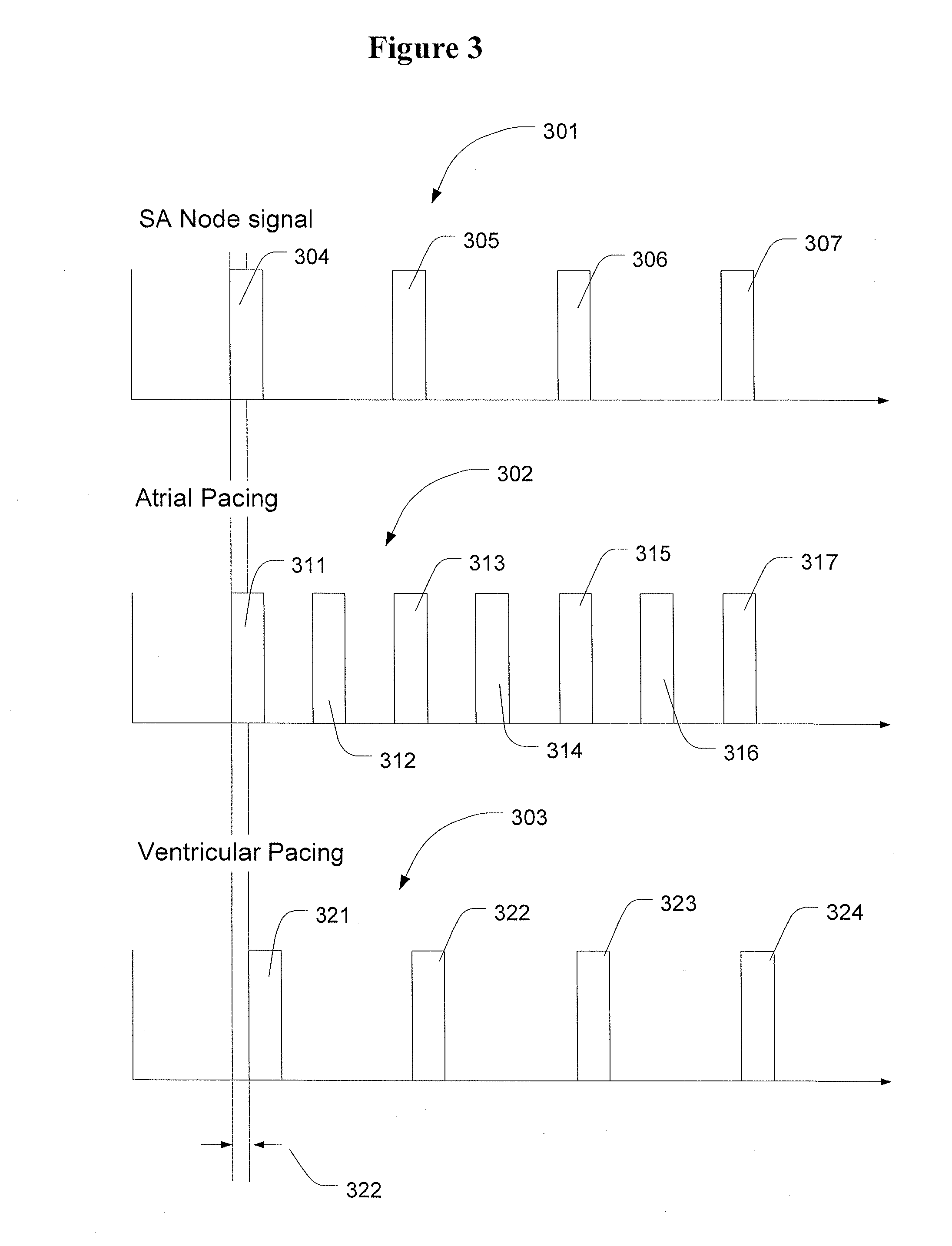 Methods and Apparatus to Stimulate the Heart